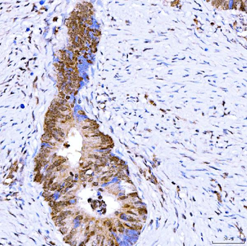 Symplekin/SYMPK Rabbit Polyclonal Antibody