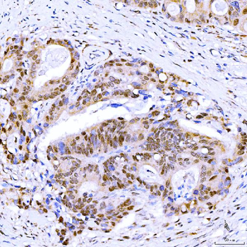 Symplekin/SYMPK Rabbit Polyclonal Antibody