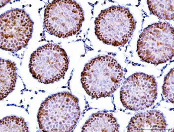 Symplekin/SYMPK Rabbit Polyclonal Antibody