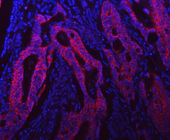 Syntaxin 18/STX18 Rabbit Polyclonal Antibody