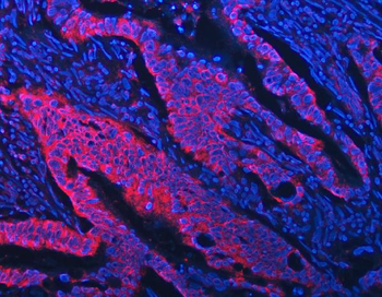 STON1 Rabbit Polyclonal Antibody
