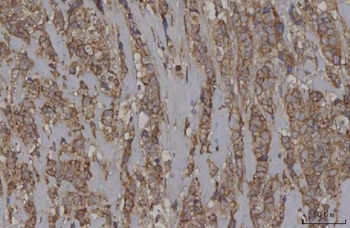 STON1 Rabbit Polyclonal Antibody