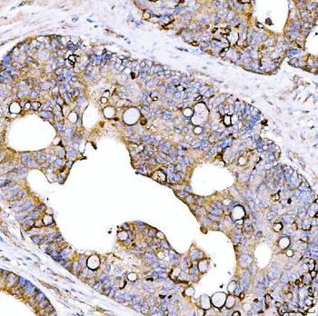 STON1 Rabbit Polyclonal Antibody