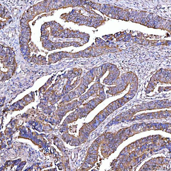 STON1 Rabbit Polyclonal Antibody