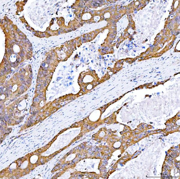 STON1 Rabbit Polyclonal Antibody