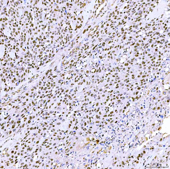 SA2/STAG2 Rabbit Polyclonal Antibody
