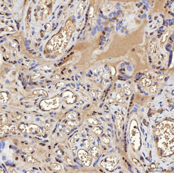SA2/STAG2 Rabbit Polyclonal Antibody