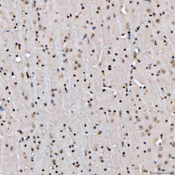 SA2/STAG2 Rabbit Polyclonal Antibody
