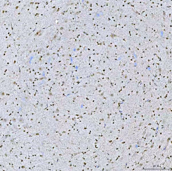 SA2/STAG2 Rabbit Polyclonal Antibody