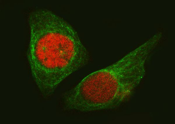 SA2/STAG2 Rabbit Polyclonal Antibody
