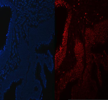 SA2/STAG2 Rabbit Polyclonal Antibody