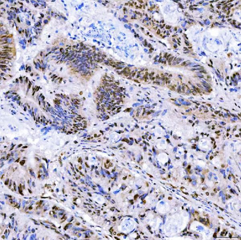SA2/STAG2 Rabbit Polyclonal Antibody