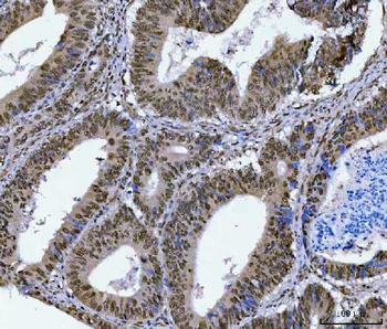 SA2/STAG2 Rabbit Polyclonal Antibody