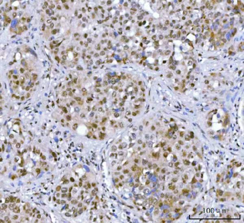 SA2/STAG2 Rabbit Polyclonal Antibody