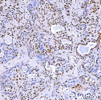 SA2/STAG2 Rabbit Polyclonal Antibody