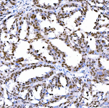 SA2/STAG2 Rabbit Polyclonal Antibody