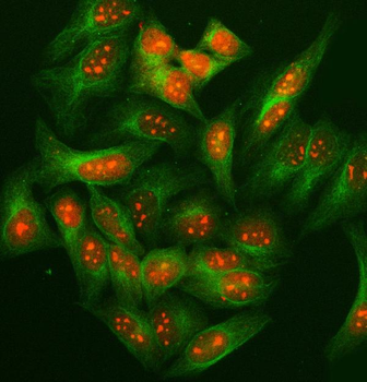 SUGT1 Rabbit Polyclonal Antibody