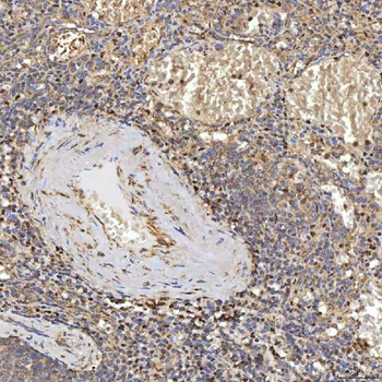 SUCLG2 Rabbit Polyclonal Antibody