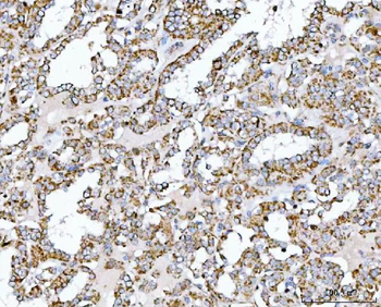 SUCLG2 Rabbit Polyclonal Antibody