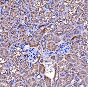 SUCLG2 Rabbit Polyclonal Antibody