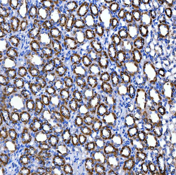 SUCLG2 Rabbit Polyclonal Antibody