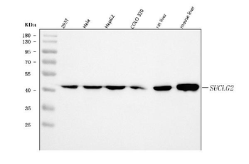 SUCLG2 Rabbit Polyclonal Antibody