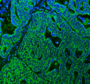 SUCLG2 Rabbit Polyclonal Antibody