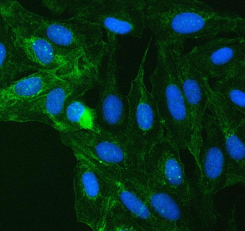 SUCLG2 Rabbit Polyclonal Antibody
