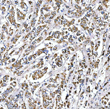 SUCLG2 Rabbit Polyclonal Antibody