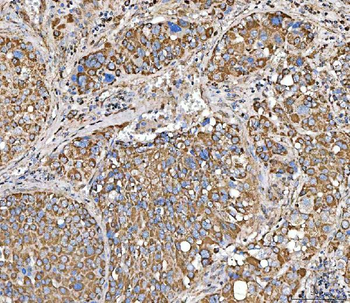 SUCLG2 Rabbit Polyclonal Antibody