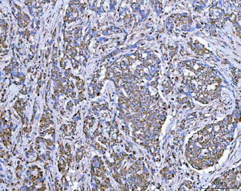 SUCLG2 Rabbit Polyclonal Antibody