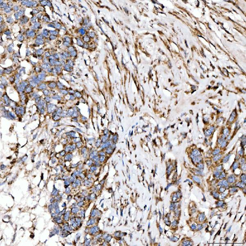 SUCLG2 Rabbit Polyclonal Antibody