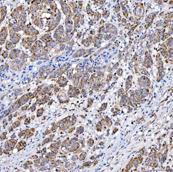 SUCLG2 Rabbit Polyclonal Antibody
