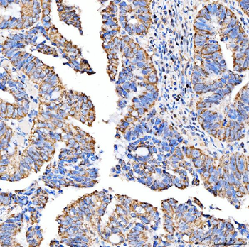 SUCLG2 Rabbit Polyclonal Antibody