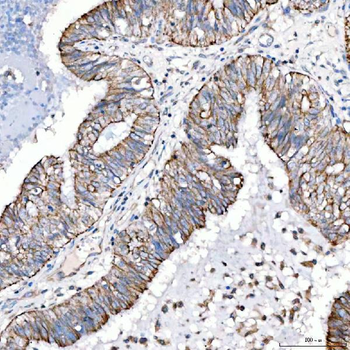 Cytokeratin 4/KRT4 Rabbit Polyclonal Antibody
