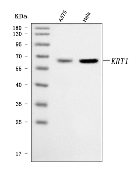 Cytokeratin 1/KRT1 Rabbit Polyclonal Antibody