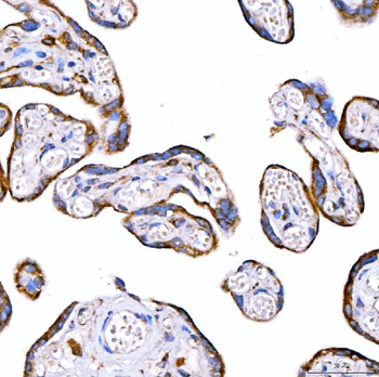 RAB7/RAB7A Rabbit Polyclonal Antibody