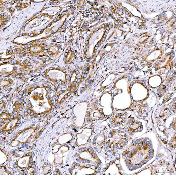 RAB7/RAB7A Rabbit Polyclonal Antibody