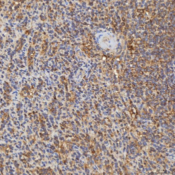 RAB7/RAB7A Rabbit Polyclonal Antibody