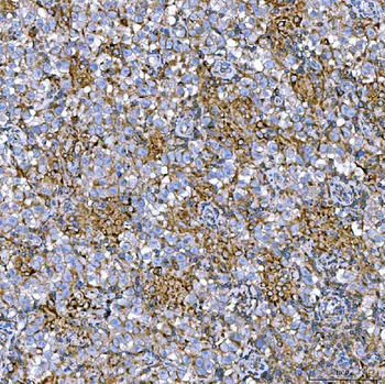 RAB7/RAB7A Rabbit Polyclonal Antibody