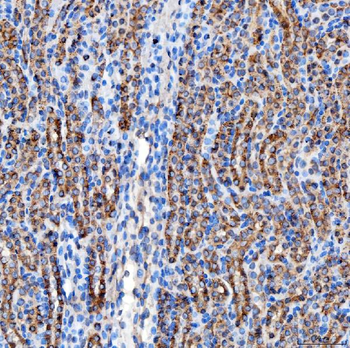 RAB7/RAB7A Rabbit Polyclonal Antibody