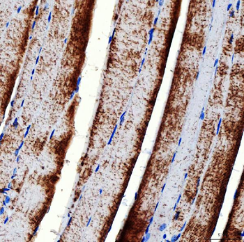 RAB7/RAB7A Rabbit Polyclonal Antibody