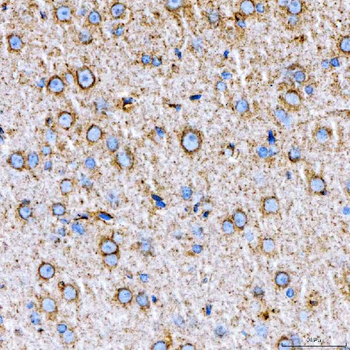 RAB7/RAB7A Rabbit Polyclonal Antibody