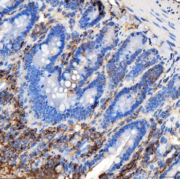 RAB7/RAB7A Rabbit Polyclonal Antibody