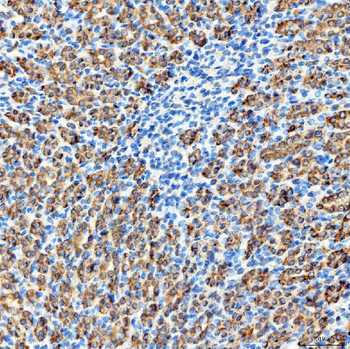 RAB7/RAB7A Rabbit Polyclonal Antibody