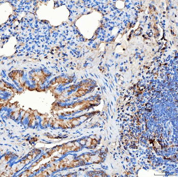 RAB7/RAB7A Rabbit Polyclonal Antibody
