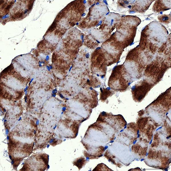 RAB7/RAB7A Rabbit Polyclonal Antibody