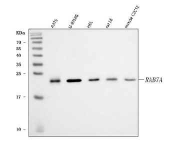 RAB7/RAB7A Rabbit Polyclonal Antibody
