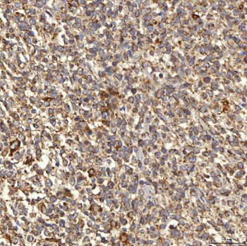 RAB7/RAB7A Rabbit Polyclonal Antibody