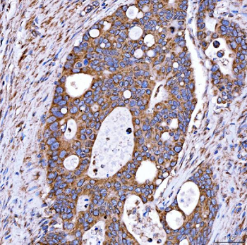 RAB7/RAB7A Rabbit Polyclonal Antibody